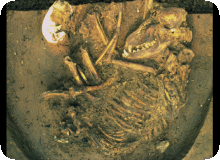 Image of Dog burial